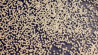 Zirblast, surface treatment